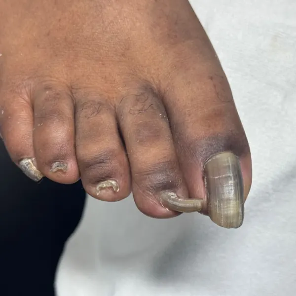 Nail work by Pure Aesthetics & Wellness