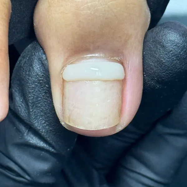 Nail work by Pure Aesthetics & Wellness