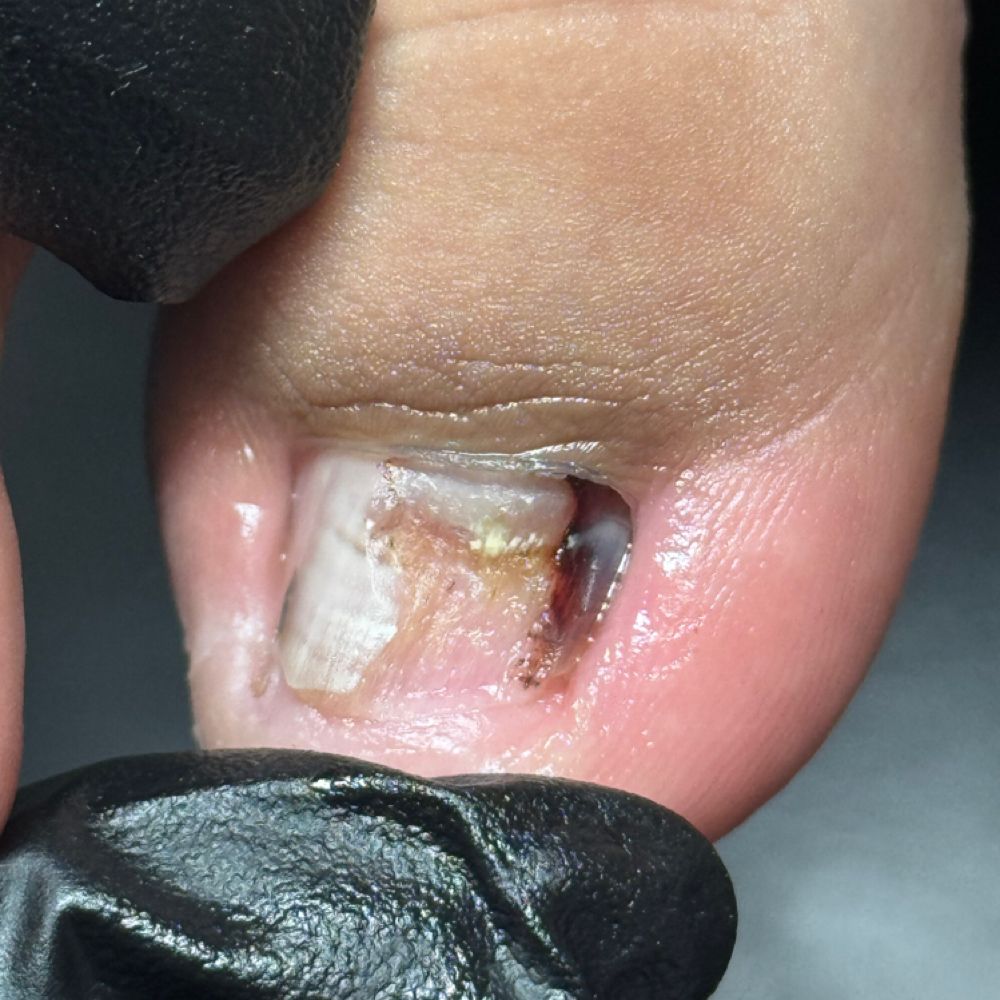 Nail work by Pure Aesthetics & Wellness
