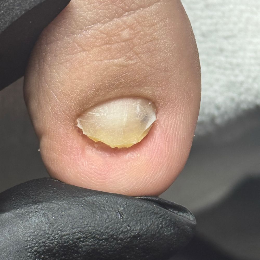 Nail work by Pure Aesthetics & Wellness